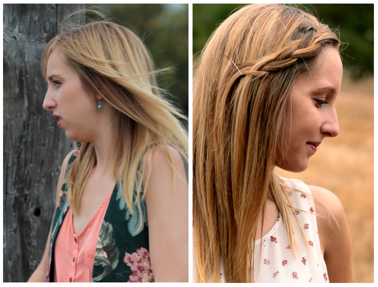 i took ibuprofen before surgery